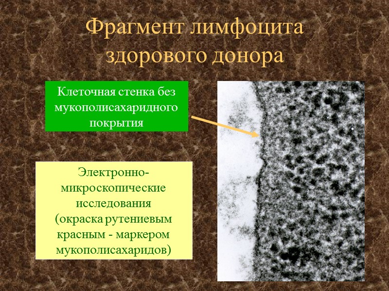 Фрагмент лимфоцита здорового донора Электронно-микроскопические исследования  (окраска рутениевым красным - маркером мукополисахаридов) Клеточная
